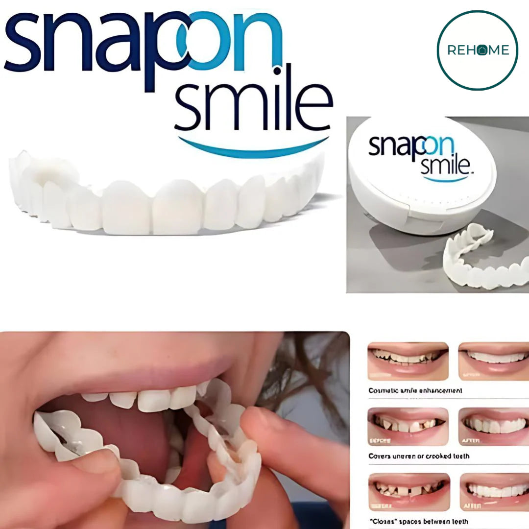 Snap-On Smile Silicone Imitation Braces – Safe & Eco-Friendly Teeth Decoration