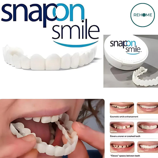 Snap-On Smile Silicone Imitation Braces – Safe & Eco-Friendly Teeth Decoration