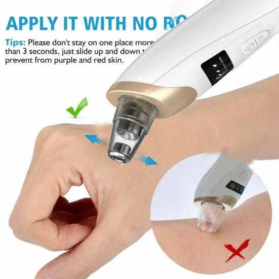 5 in 1 Electric Blackhead Acne Oil Remover Vacuum Suction Face Pore Cleaner Machine