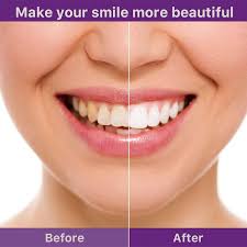 Hi-Smile v34 Original purple teeth whitening serum 30ML Stain Removal & Oral Cleaning