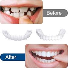 Snap-On Smile Silicone Imitation Braces – Safe & Eco-Friendly Teeth Decoration